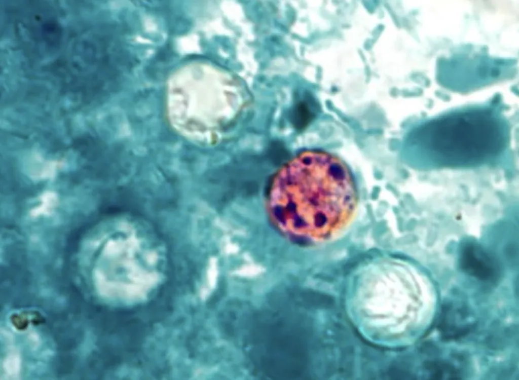 Autoridades sanitarias monitorean el brote de cyclospora cayetanensis en Estados Unidos ante el incremento de casos y hospitalizaciones.